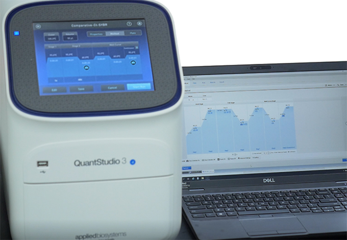 실시간유전자증폭정량분석