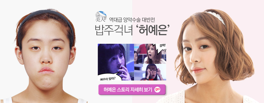 허예은