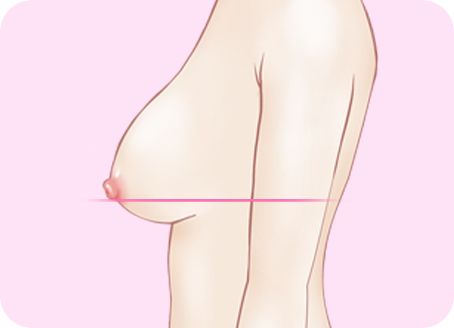 1단계