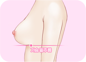 정상