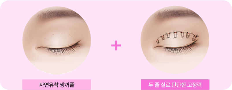 더블락 매몰법