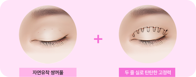더블락 매몰법