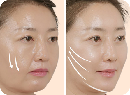 탄탄한 V라인