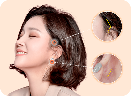 리프팅 효과는 보여도 흉터는 숨겨야지!