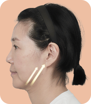 늘어진 하안부