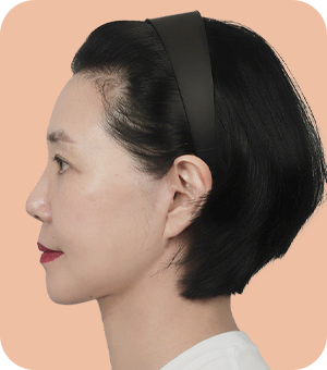 동안 턱선 완성!