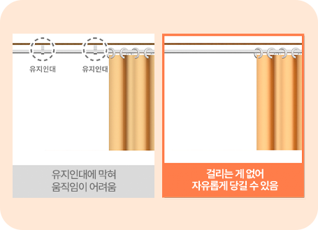 유지인대까지 제거해 더넓게 더 오래가게!