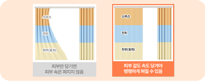 처짐 방지를 위한 3중 고정