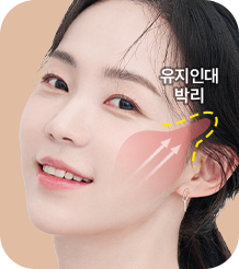근막층을 지탱하는 유지인대 끊기