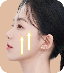 스마스층, 진피, 표피까지 단단한 3중 고정