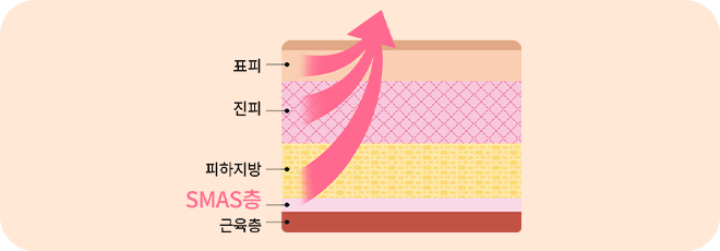 수술당일 즉시효과!