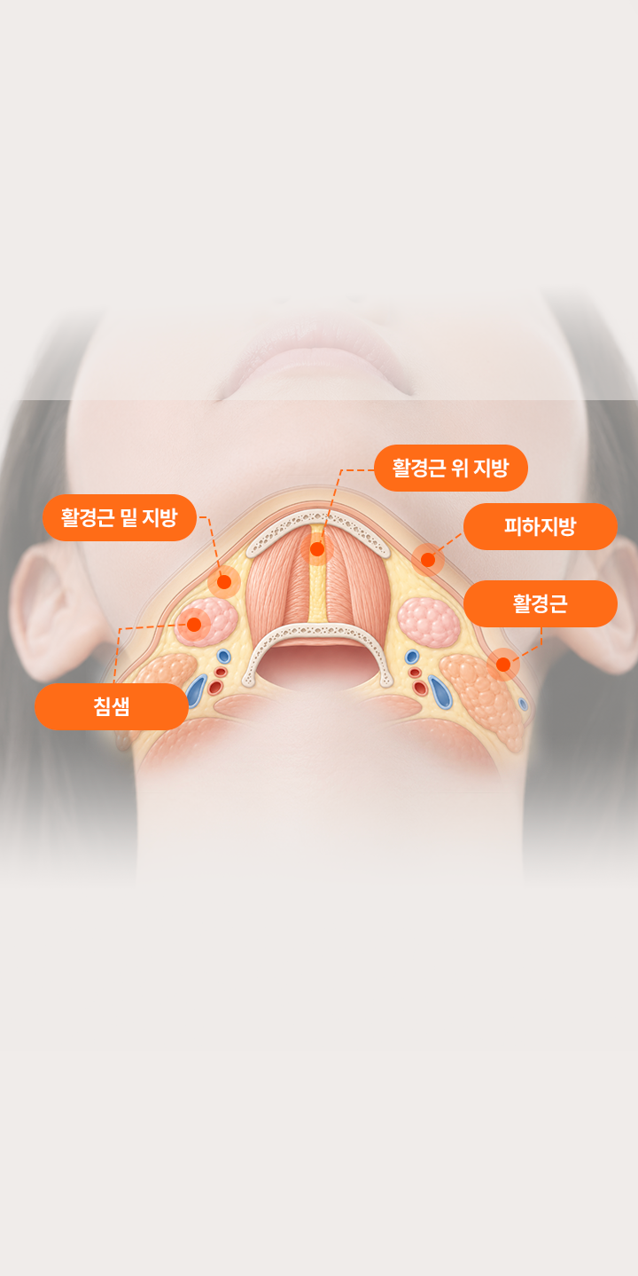 아이디병원 - 활경근, 피하지방, 침샘 등 턱선 구조 - 리프팅