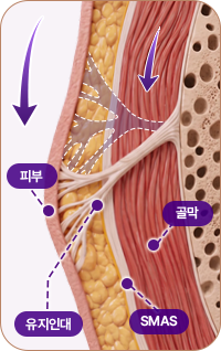 아이디병원 - 중안부 리프팅 - 중력으로 인한 처짐 - 리프팅
