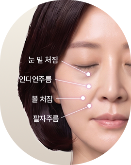 아이디병원 - 중안부 리프팅 수술방법 - 처짐 진단 - 리프팅