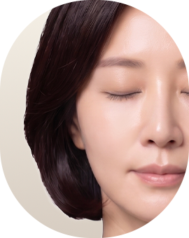 아이디병원 - 중안부 리프팅 수술방법 - 짧아진 중안면부 - 리프팅