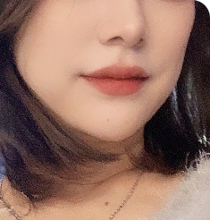 아이디병원 - 처진 턱선, 이중턱 - After - 리프팅