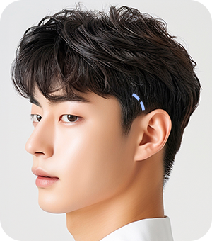 1cm 최소절개