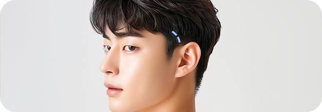 1cm 최소절개