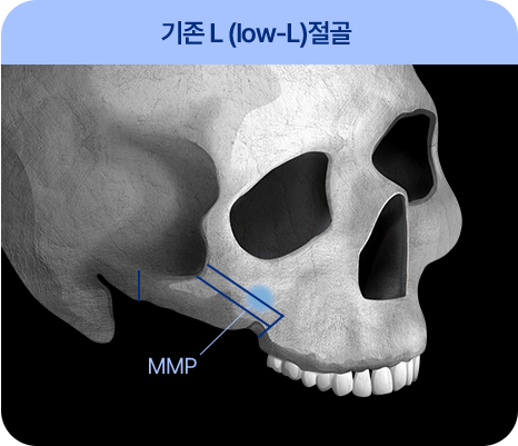 처진 피부탄력까지 UP