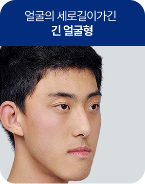 긴 얼굴형형