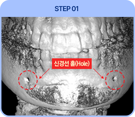 STEP01