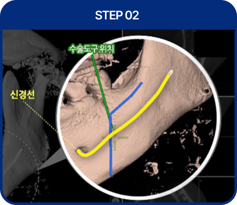 STEP02