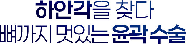 얼굴형에 하안각을 찾다 뼈까지 멋있는 윤곽수술