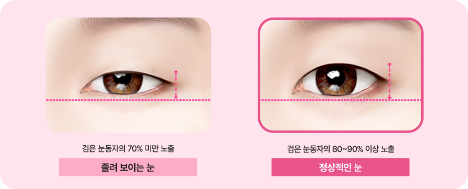 눈뜨는 힘과 보이는 범위도 확실하게