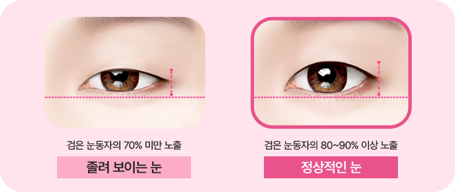 눈뜨는 힘과 보이는 범위도 확실하게