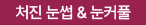 처진눈썹 눈꺼풀