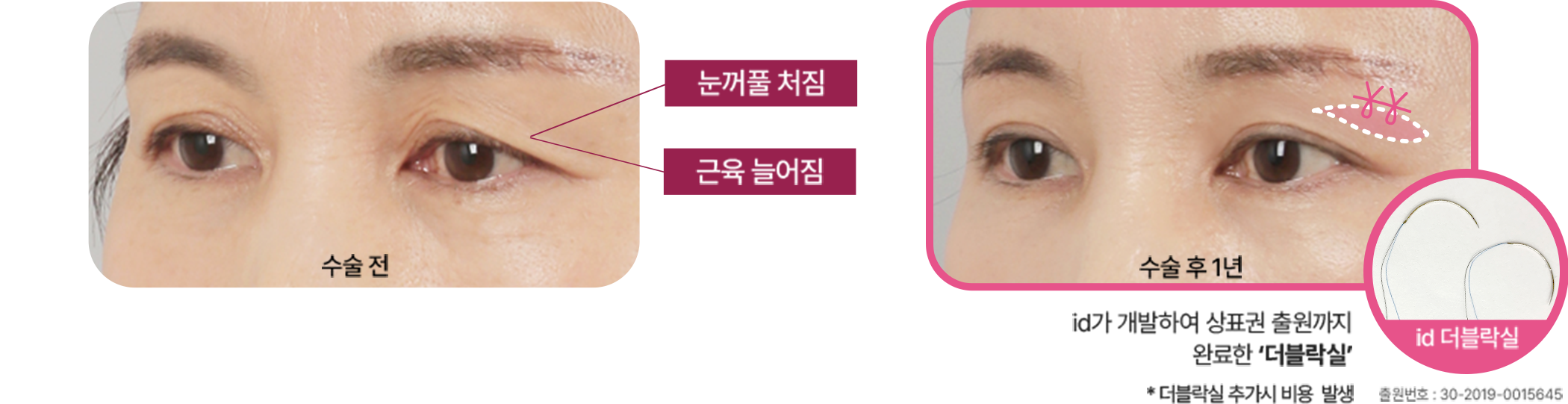 눈뜨는 힘과 보이는 범위도 확실하게