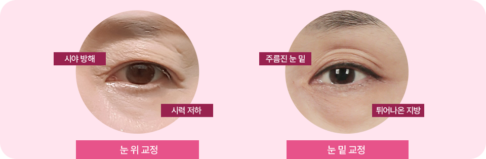 눈뜨는 힘과 보이는 범위도 확실하게
