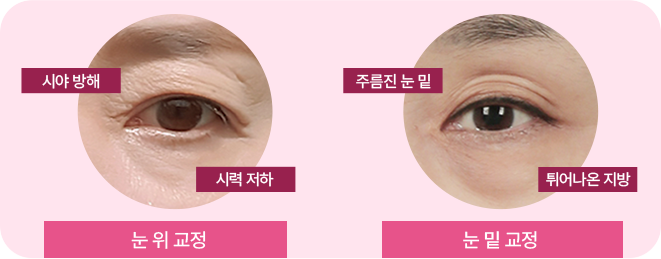 눈뜨는 힘과 보이는 범위도 확실하게