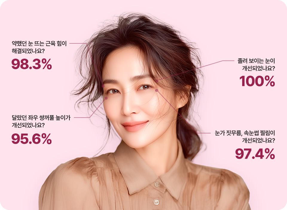 아이디병원 처진눈 솔루션 결과 이미지 