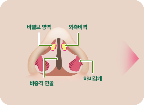 비밸브영역. 외측비벽. 비중격 연골. 하비갑개
