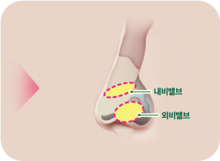 내비밸브, 외비밸브
