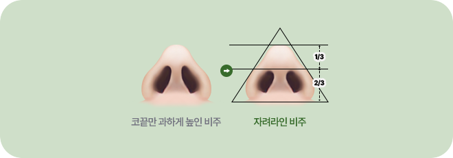 자려라인 비주