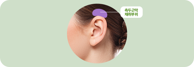 측두근막 채취부위