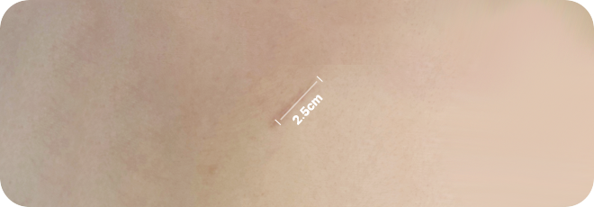 2.5cm