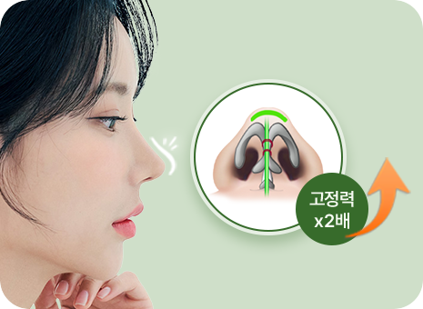 고정력 2배