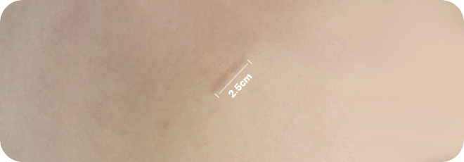 2.5cm