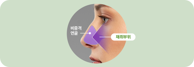 비중격 연골. 채취부위