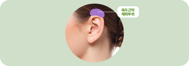 측두근막 채취부위