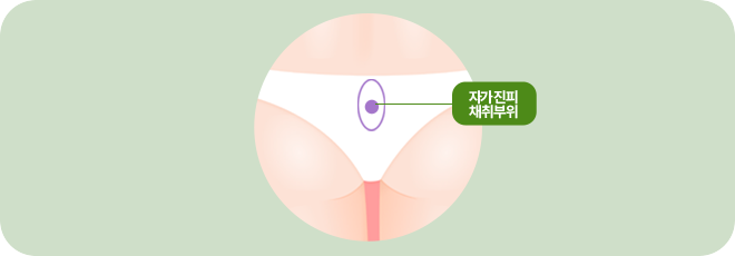 자가진피 채취부위