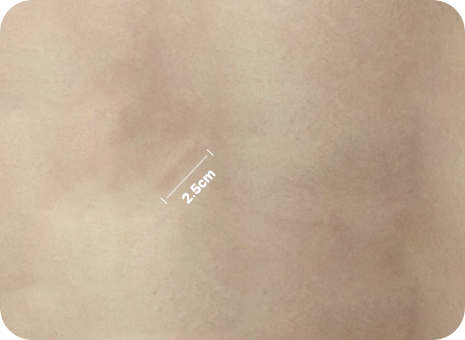 2.5cm