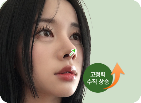 고정력 수직 상승