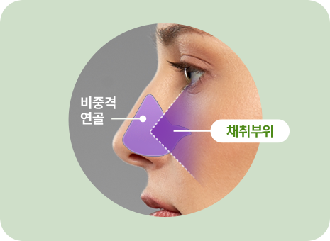 비중격 연골. 채취부위