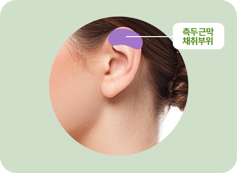 측두근막 채취부위