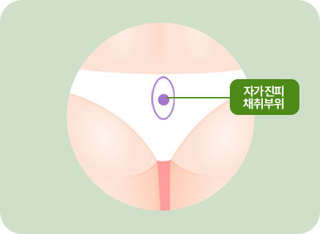 자가진피 채취부위
