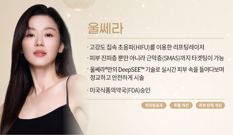 울쎄라mo